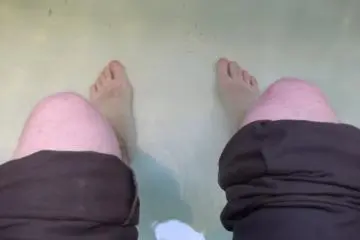 <p>Soaking my feet after lunch</p>