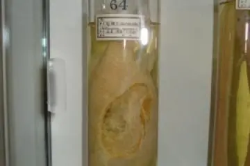 Fungus Fish